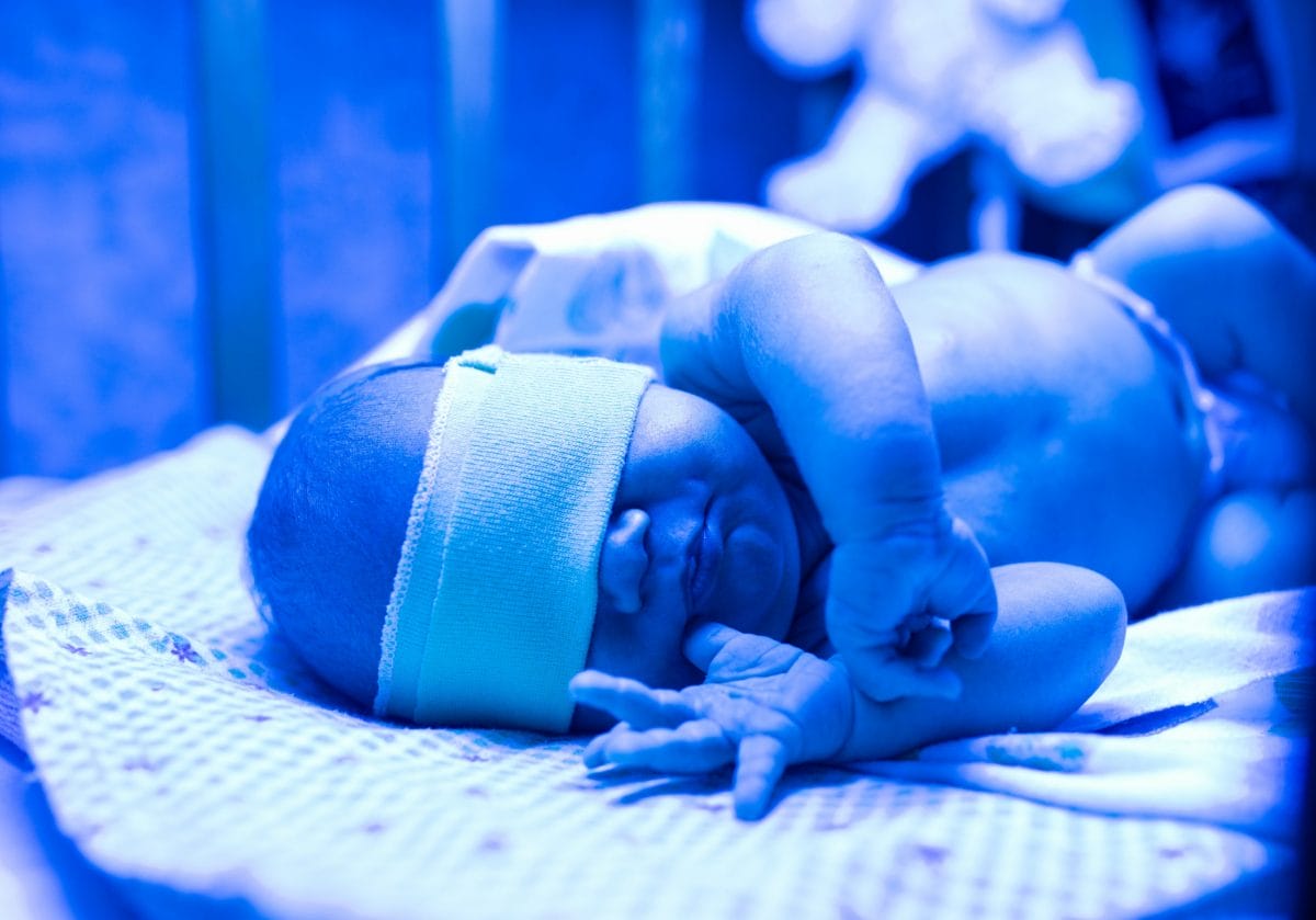 newborn-having-a-treatment-for-jaundice-under-ultr-2021-08-29-09-55-17-utc-scaled.jpg?strip=all&lossy=1&fit=1200%2C839&ssl=1